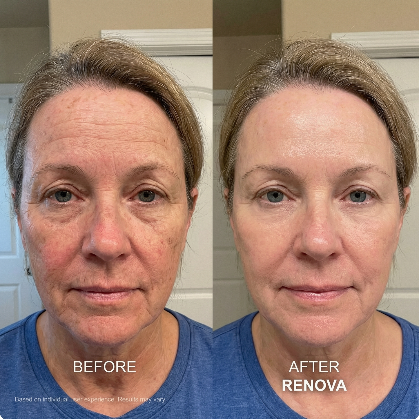 Anti-Aging GHK-CU Micro Infusion