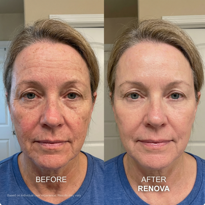 Anti-Aging GHK-CU Micro Infusion