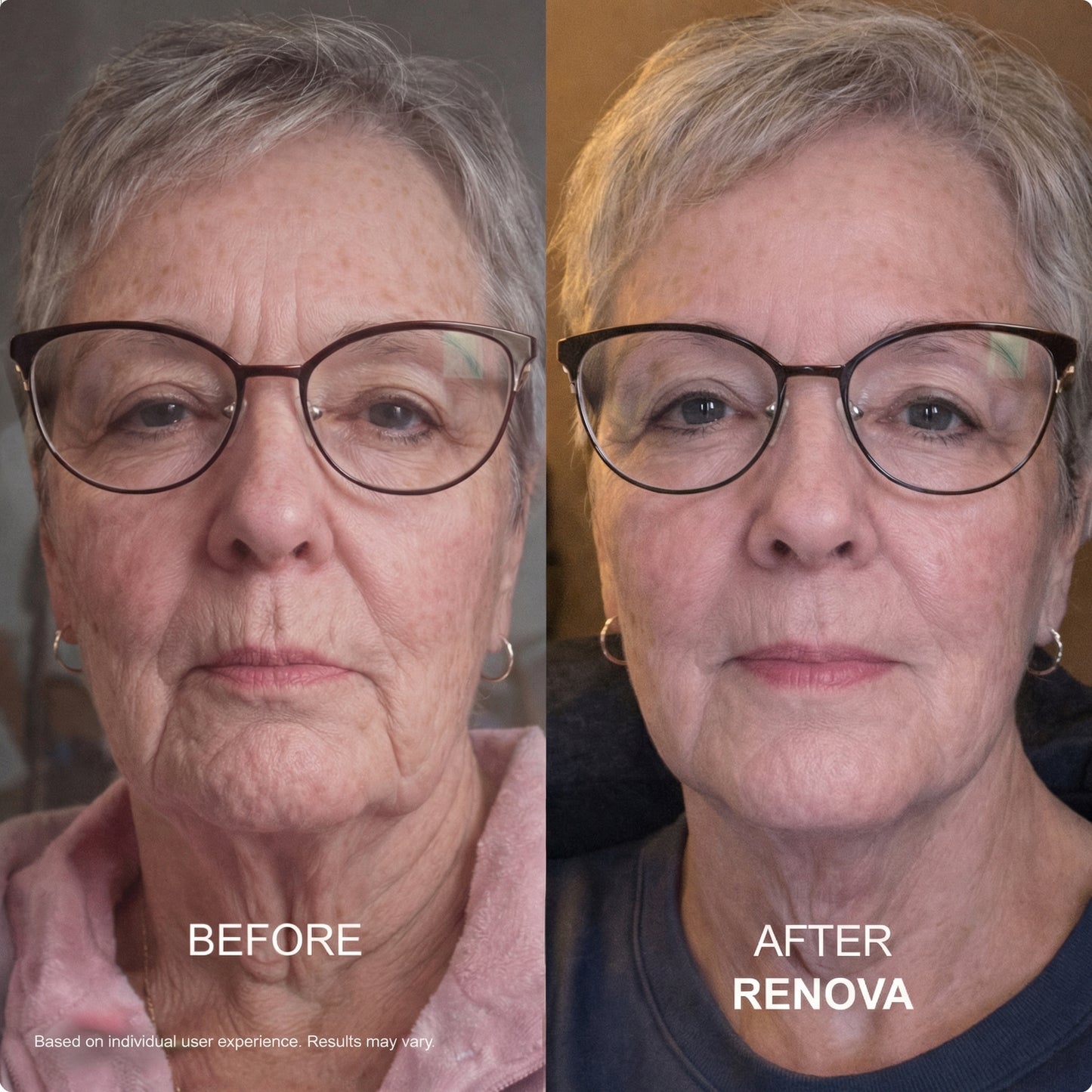Anti-Aging GHK-CU Micro Infusion