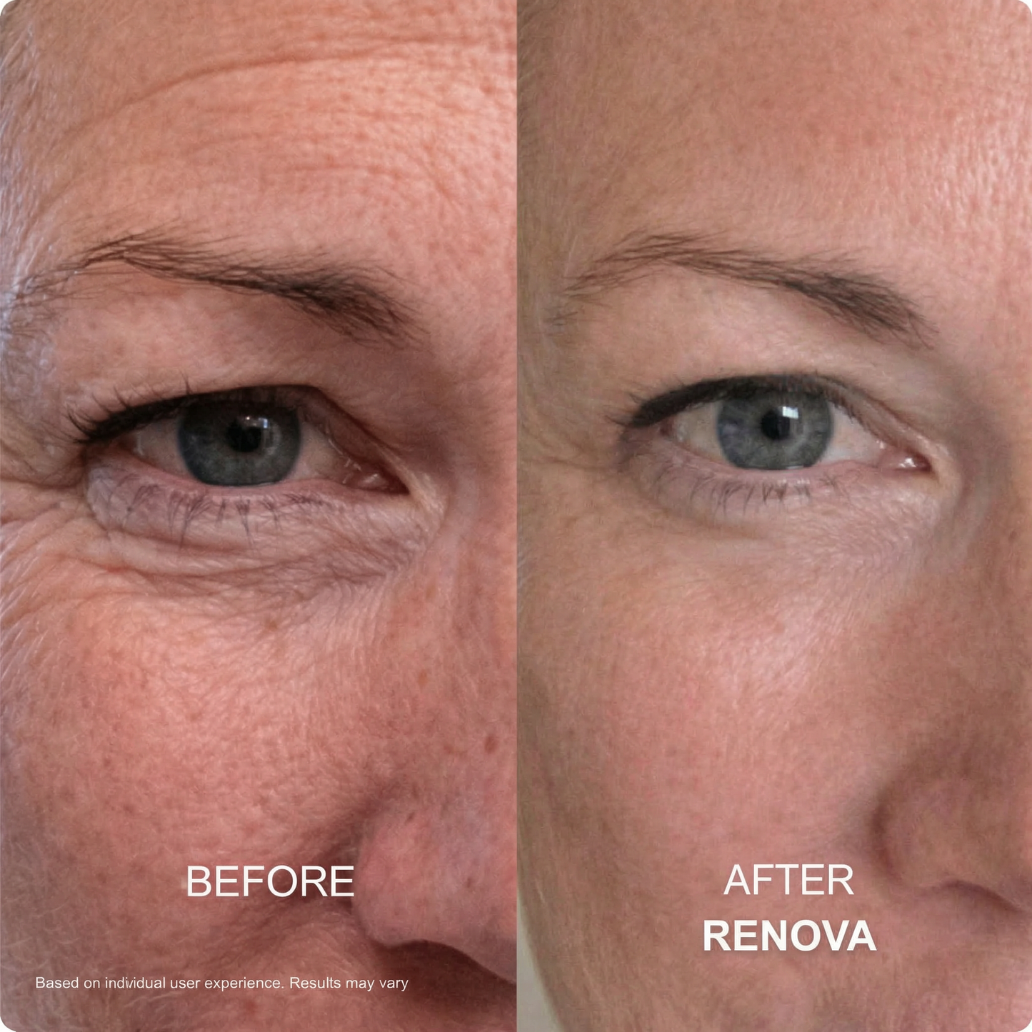 Anti-Aging GHK-CU Micro Infusion