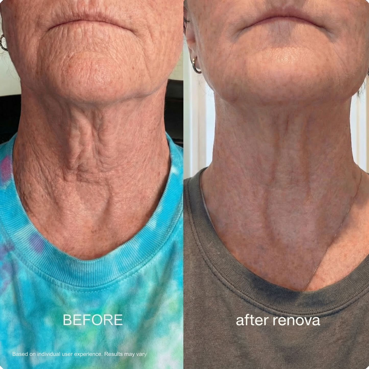 Anti-Aging GHK-CU Micro Infusion