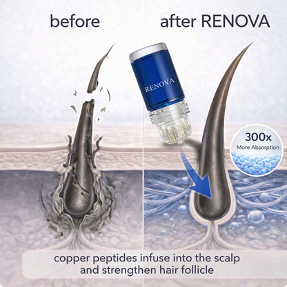 Peptide Hair Regrowth Micro Infusion Kit